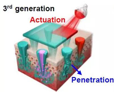第三代：通过微针介导的皮肤层破坏和微针伴随的各种功能增强药物转运.jpg