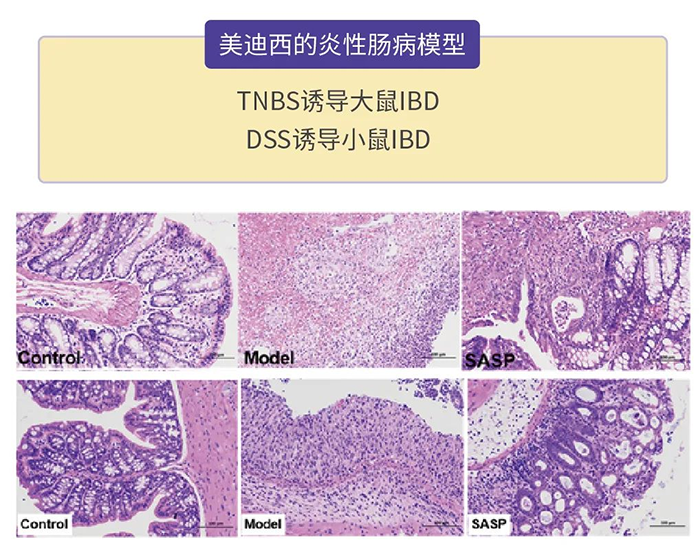 人生就是博的炎性肠病模型.png