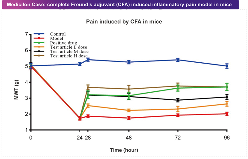 人生就是博案例：CFA致痛模型.jpg